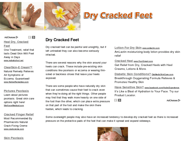 www.drycrackedfeet.org