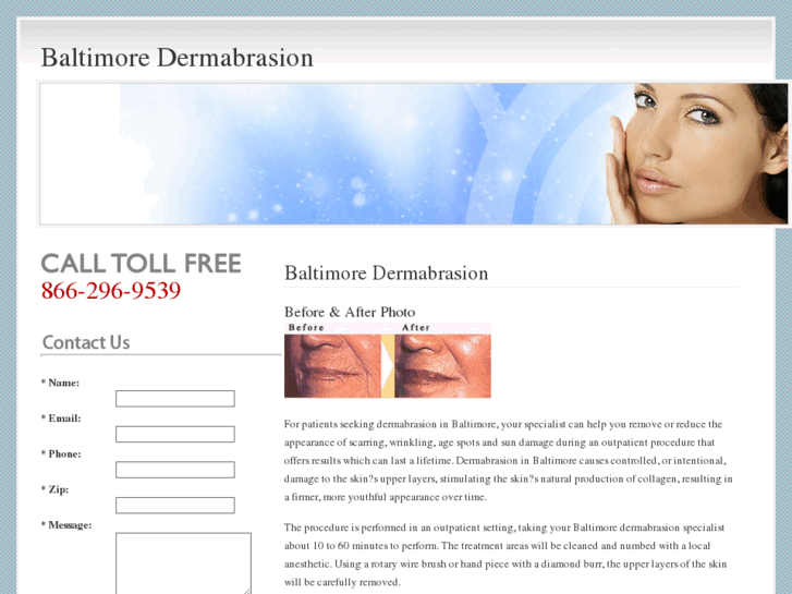 www.baltimoredermabrasion.com