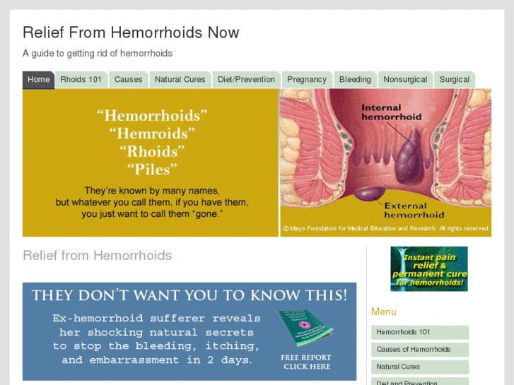 www.relief-from-hemorrhoids.com