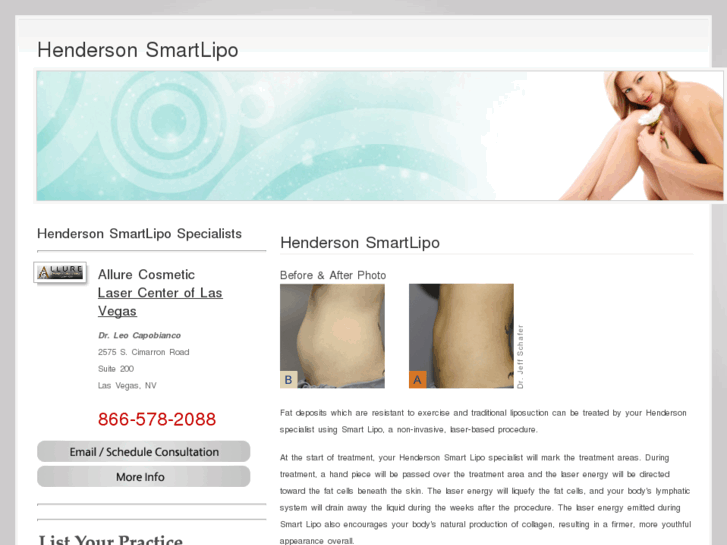 www.hendersonsmartlipo.com