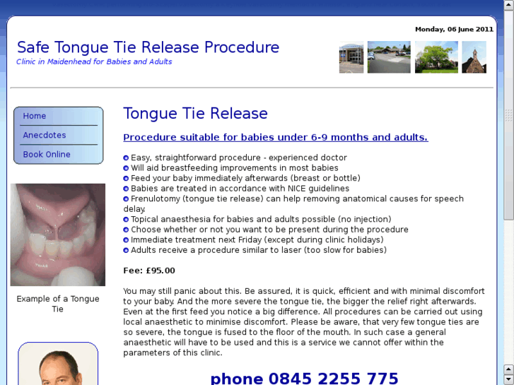 www.tongue-tie-release.co.uk