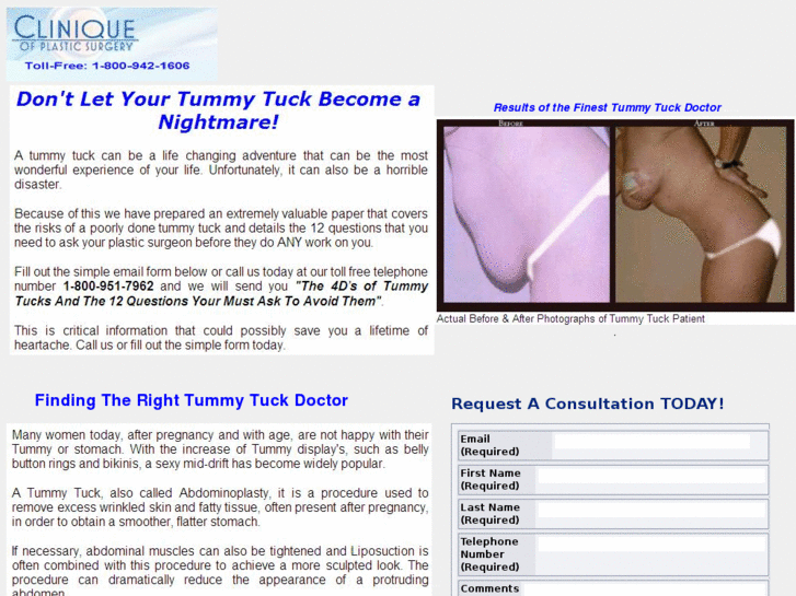 www.tummy-tuck-doctor.com