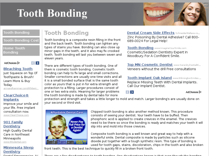 www.toothbond.net