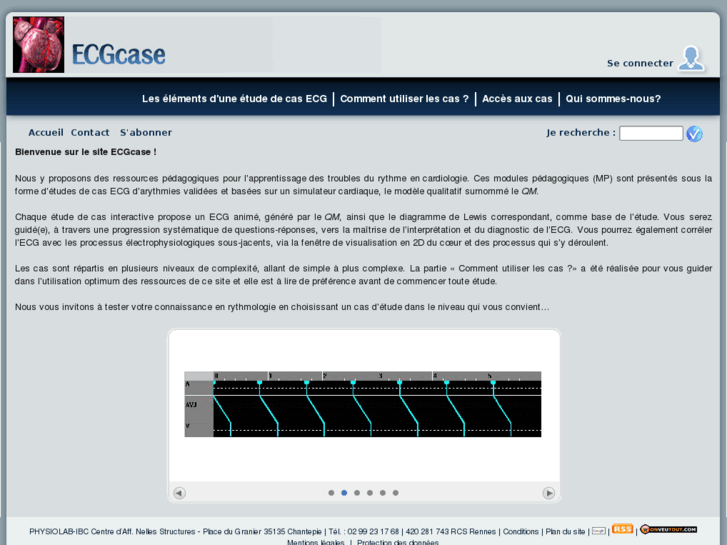 www.ecgcase.com