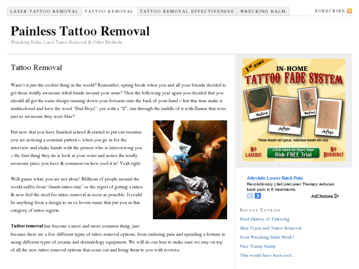 www.painlesstattooremoval.net