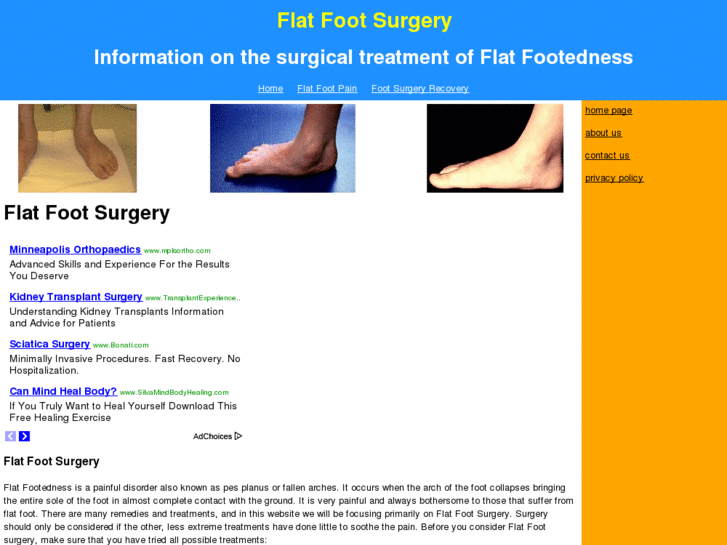 www.flatfootsurgery.net