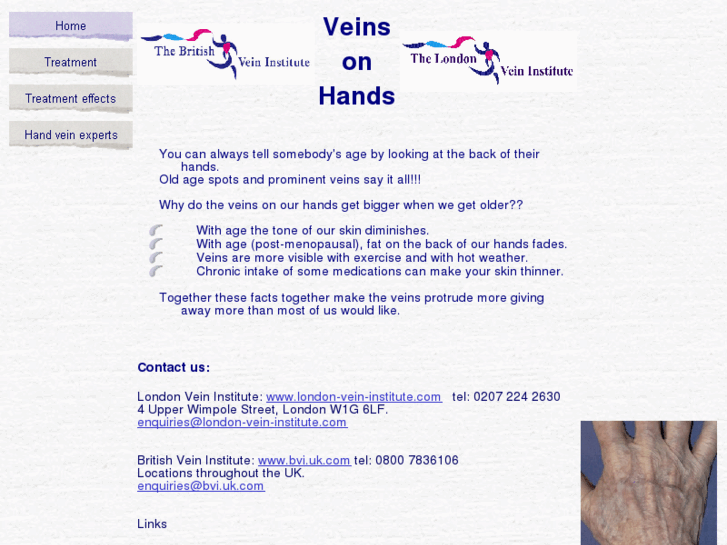 www.veins-on-hands.com