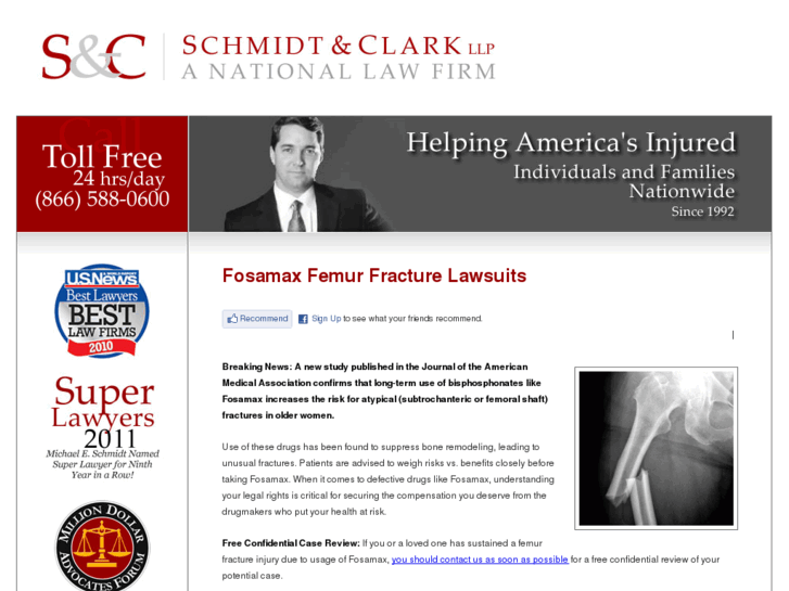 www.fosamaxfemurfracturelawsuits.com