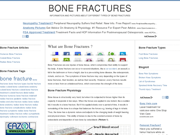 www.bonefractures.org