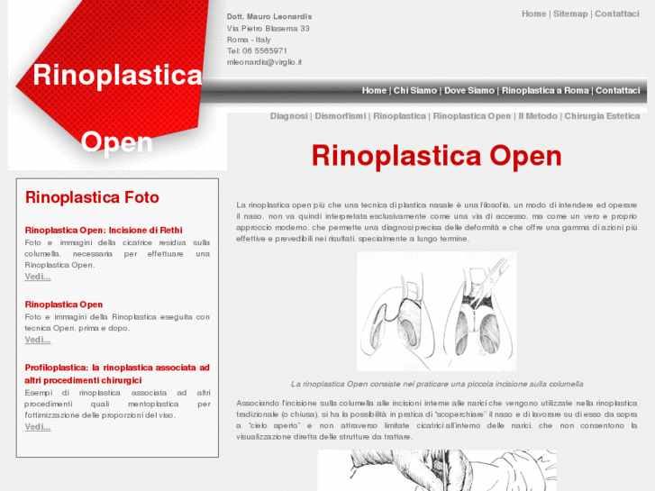 www.rinoplasticaopen.com