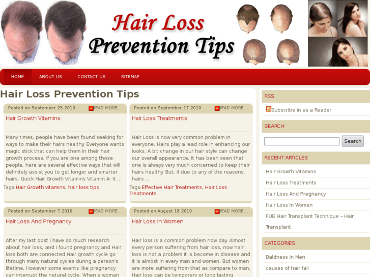 www.hairlosspreventiontips.net