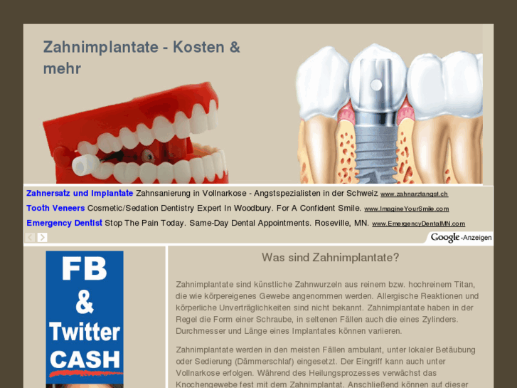 www.top-zahnimplantate.de