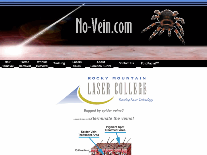 www.no-vein.com