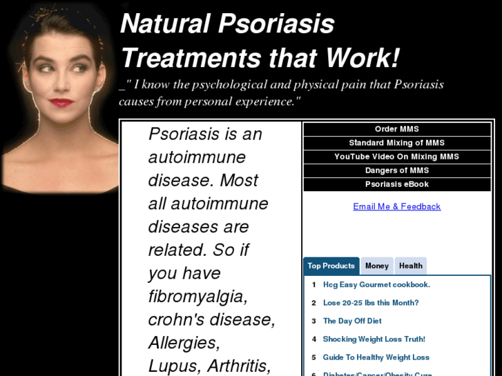 www.psoriasis-treatments-that-work.com