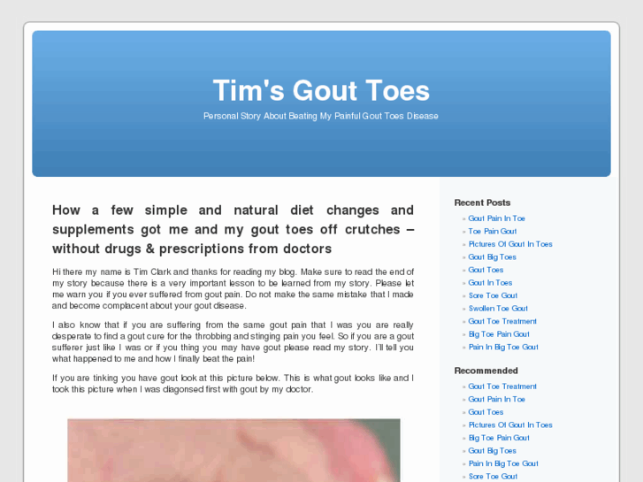 www.timsgouttoes.org