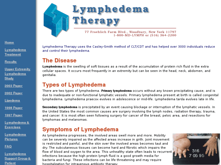 www.lymphedema-ny.com