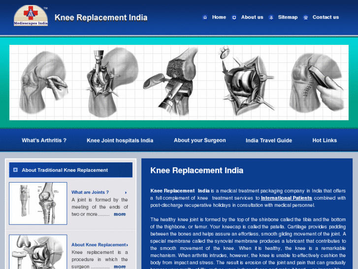 www.kneereplacementindia.com