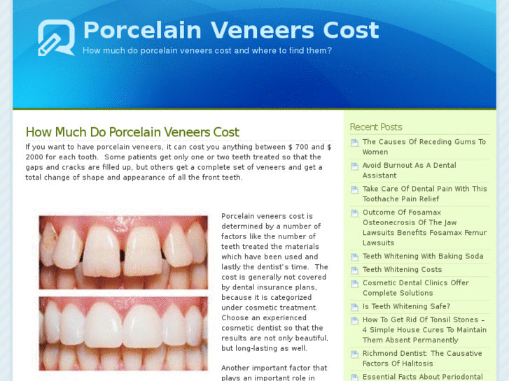 www.porcelainveneerscost.biz