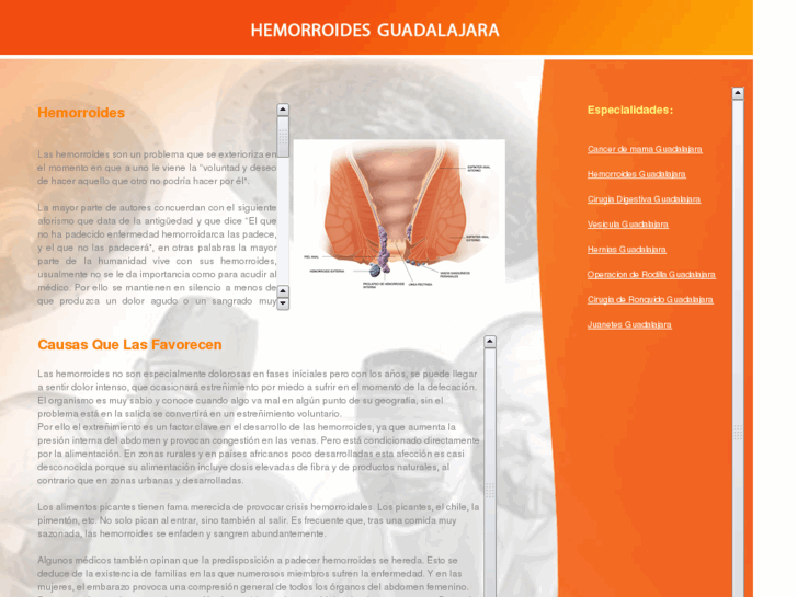 www.hemorroidesguadalajara.com