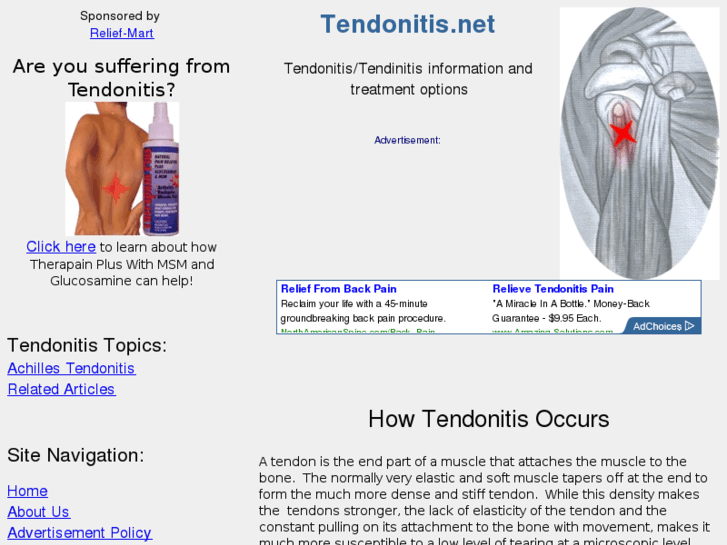 www.tendonitis.net