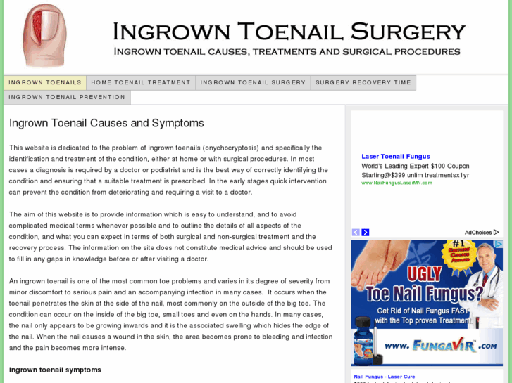 www.ingrowntoenailsurgery.org