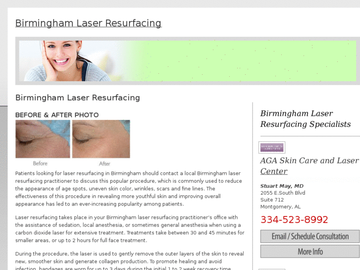 www.birminghamlaserresurfacing.com