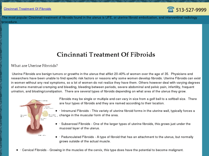 www.cincinnatitreatmentoffibroids.com