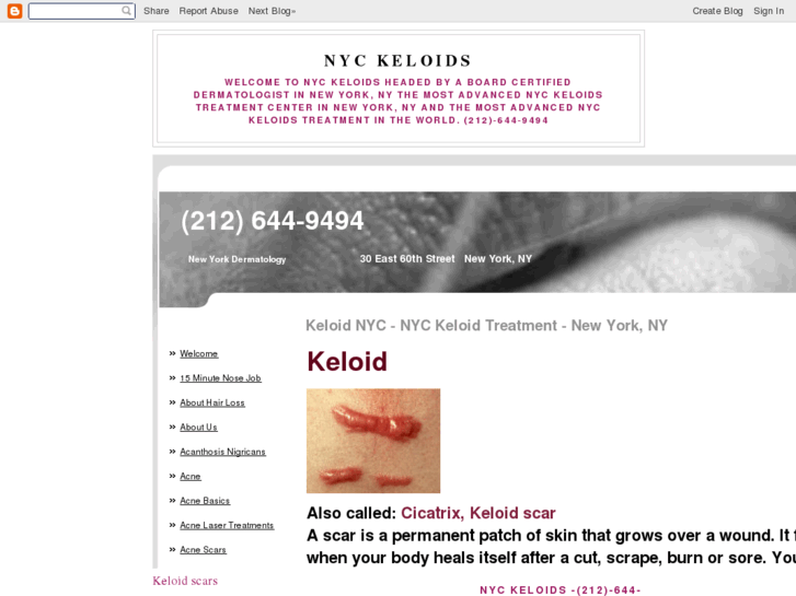 www.nyckeloids.org