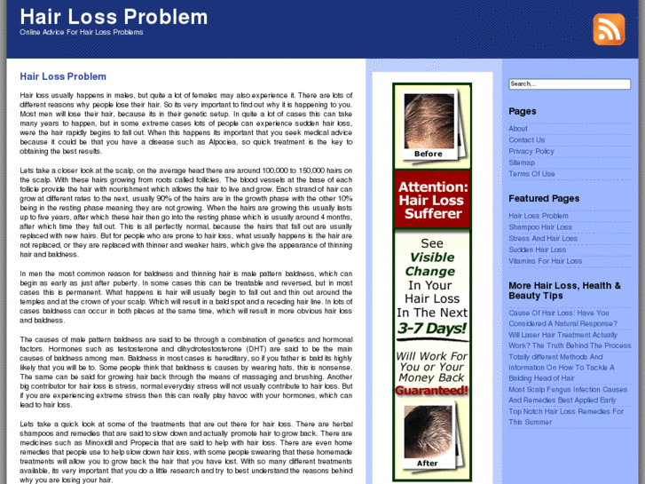 www.hair-loss-problem.com