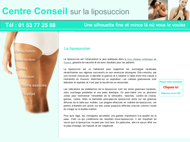 www.lipo-succion.com