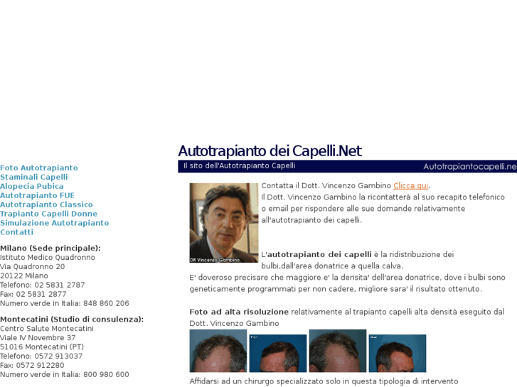 www.autotrapiantocapelli.net