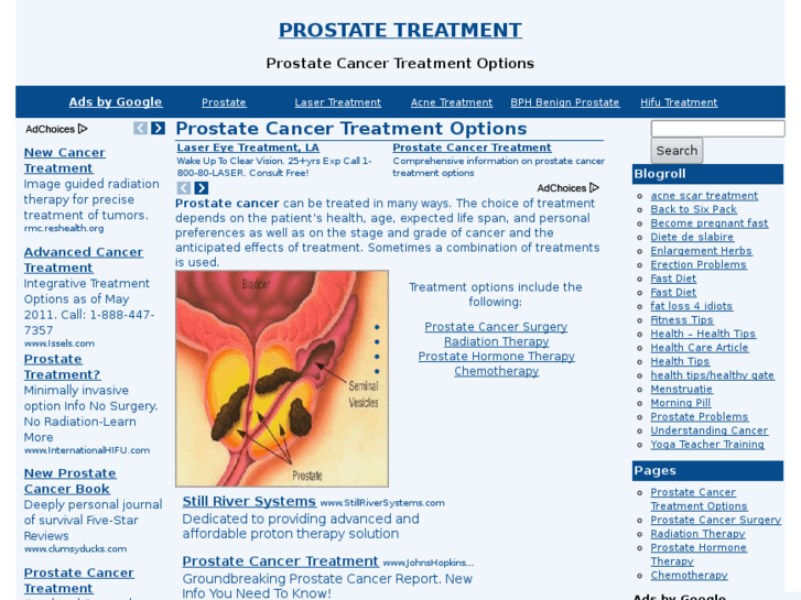 www.prostatetreatmentt.com