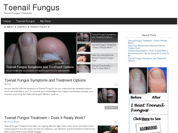 www.toenailfungus101.org