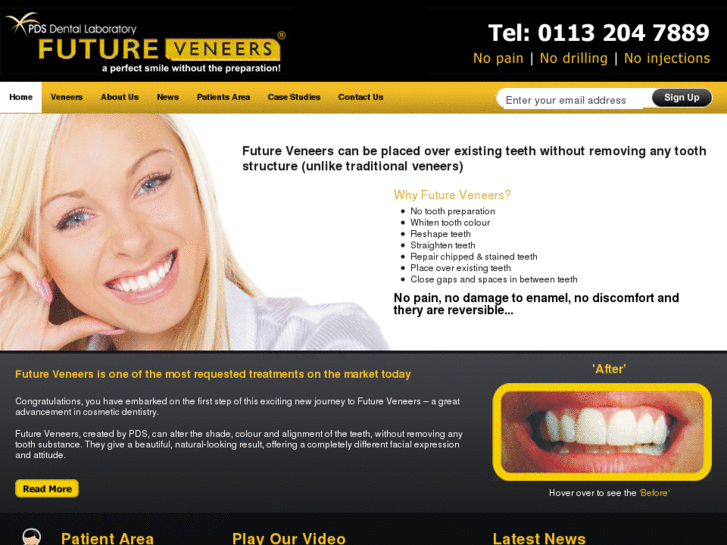 www.futureveneers.com