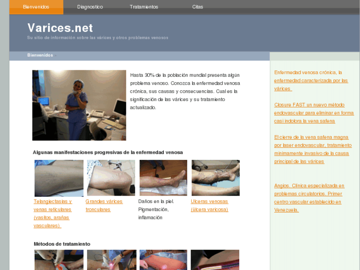 www.varices.net