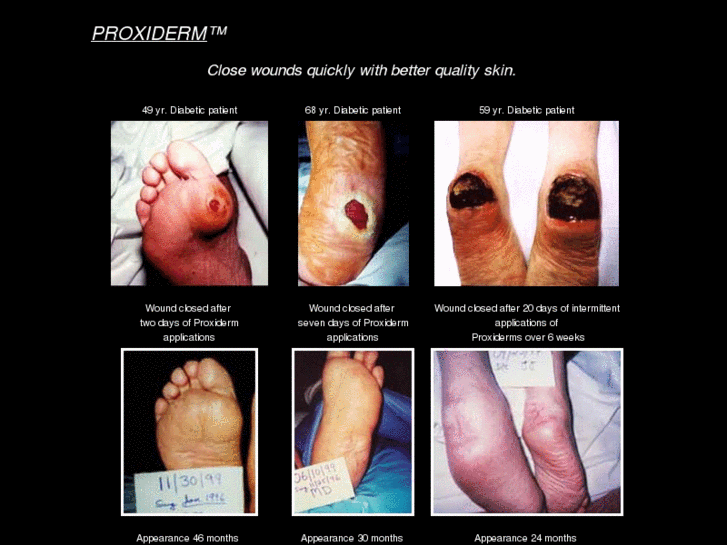 www.proxiderm.com