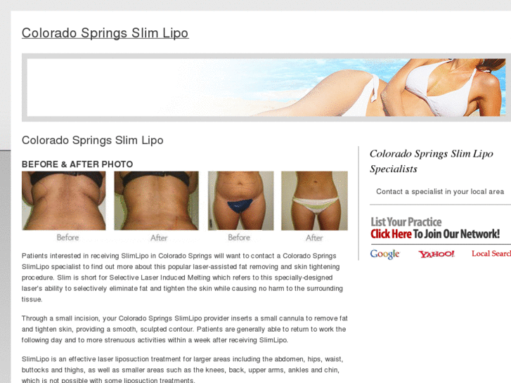 www.coloradospringsslimlipo.com