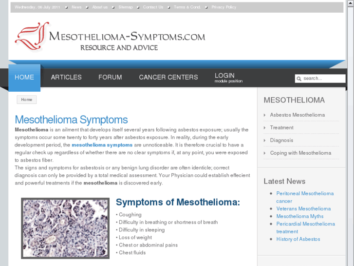 www.mesothelioma-symptoms.com