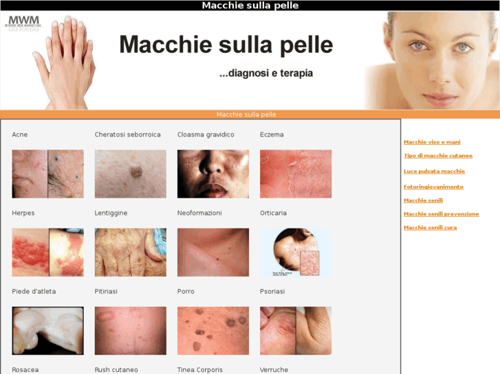 www.macchiesullapelle.com