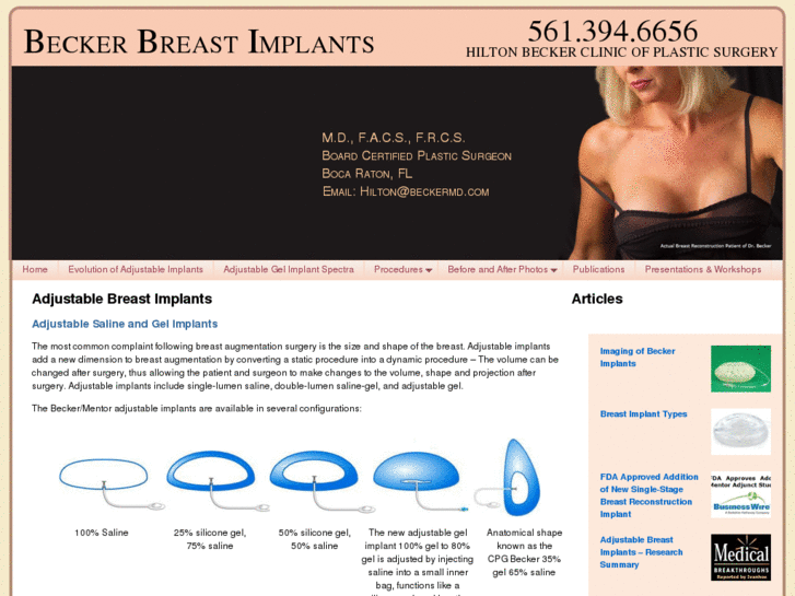 www.beckerbreastimplant.com