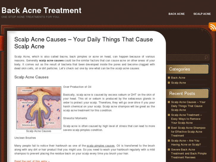 www.back-acne-treatment.net