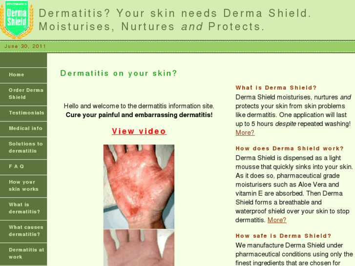 www.dermatitis-page.info