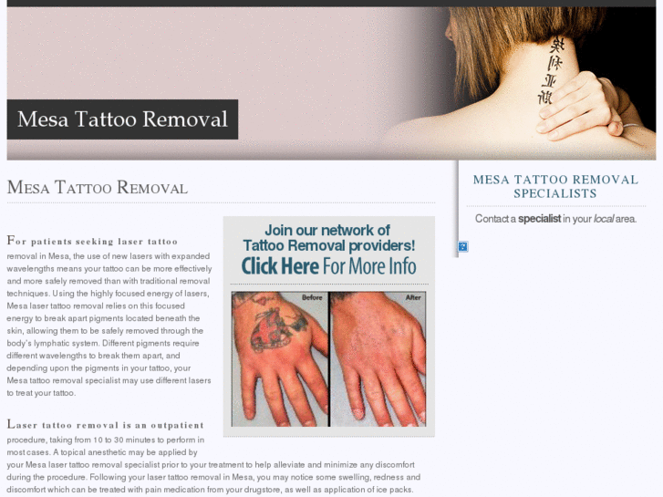 www.mesalasertattooremoval.com