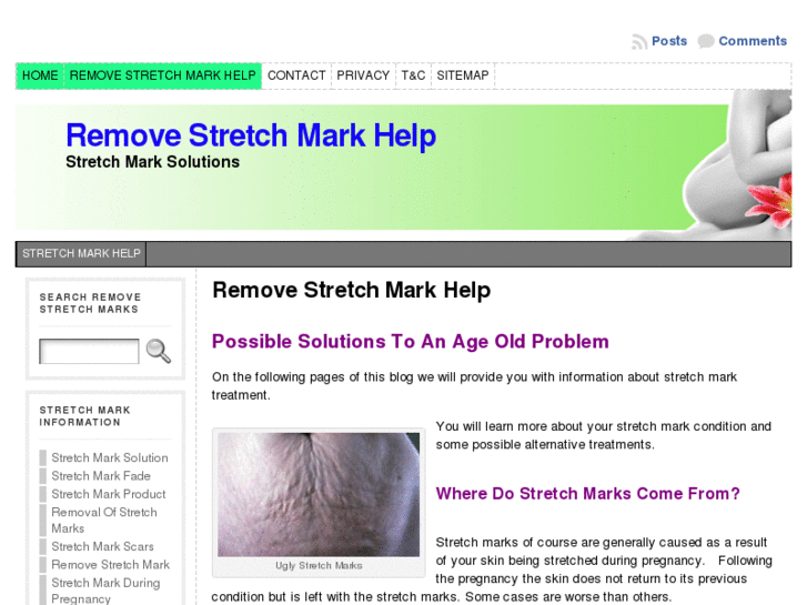 www.removestretchmarkhelp.com