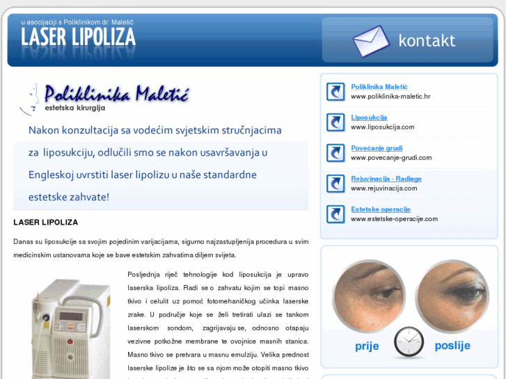 www.laserlipoliza.com