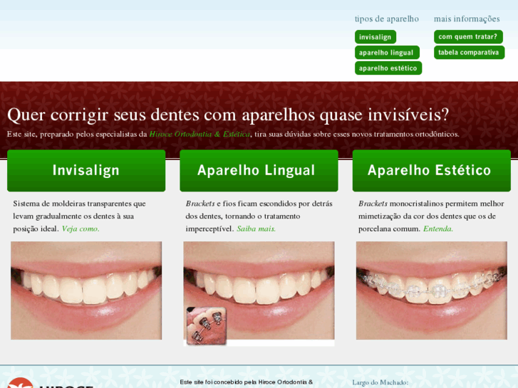 www.aparelhosinvisiveis.com