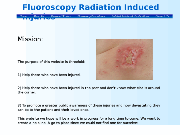 www.radiationburninjuriessite.info