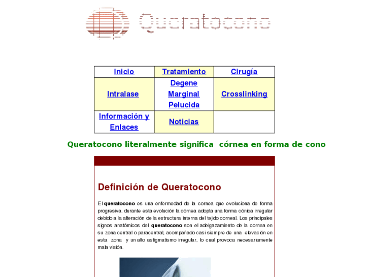 www.queratocono.es