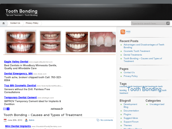 www.toothbonding.org