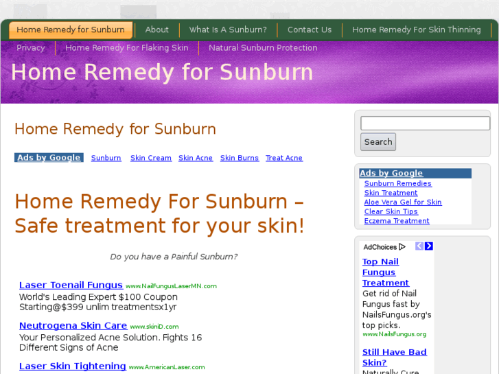 www.homeremedyforsunburn.com